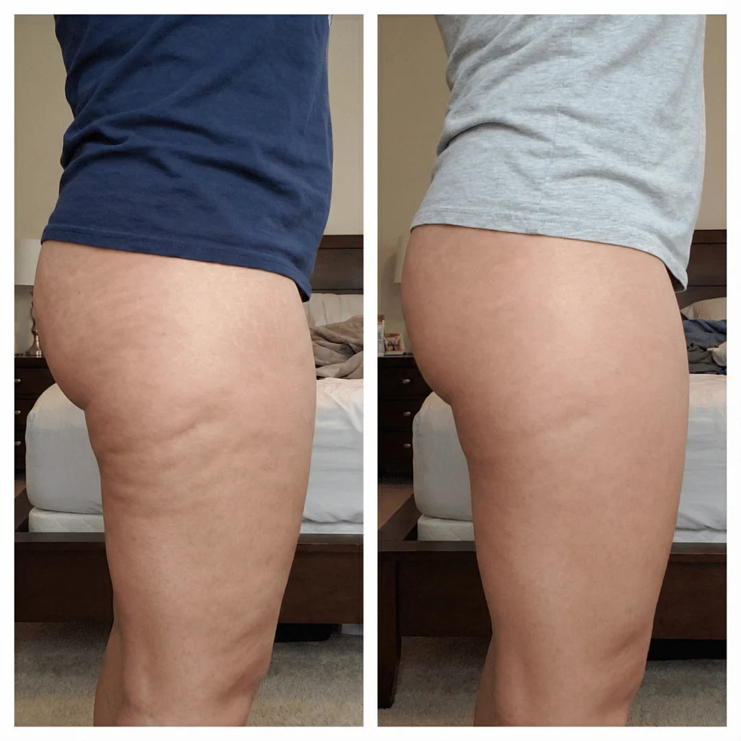 Anti-Cellulite Massage Oil