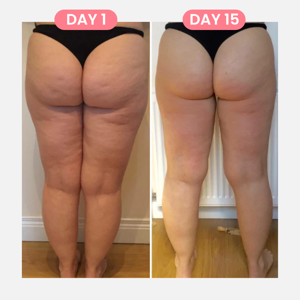 CelluSculpt™